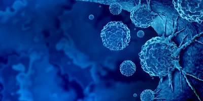Células cancerosas azules adheridas a la superficie celular sobre un fondo azul brillante en una representación 3D de una infección por cáncer.