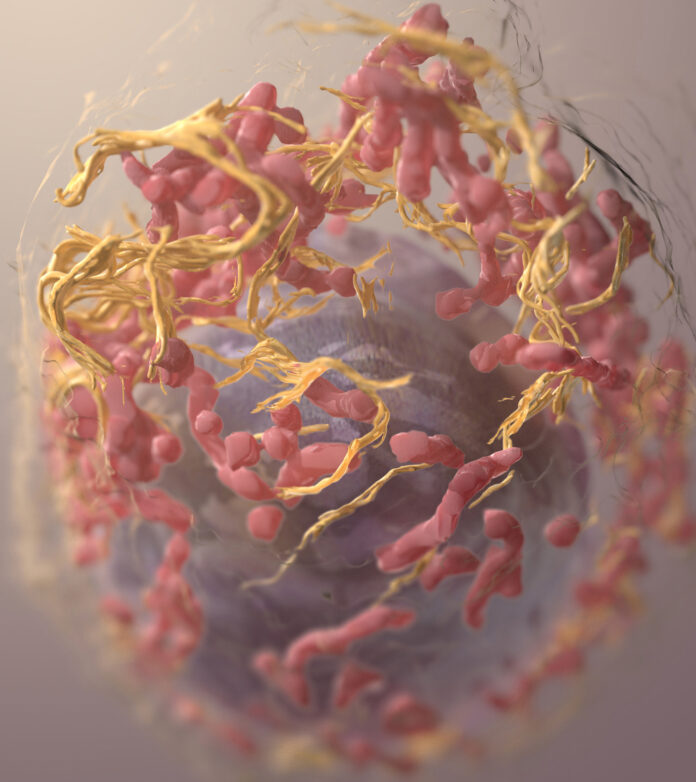 getty_544541813_melanoma Estructura 3D de una célula de melanoma obtenida mediante microscopía electrónica de barrido por abrasión iónica.
