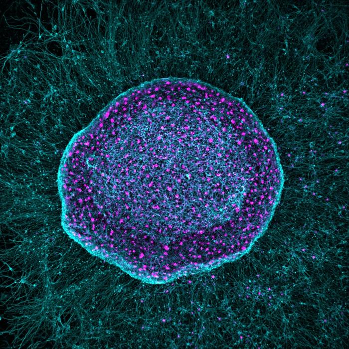 SereNeuro Therapeutics presentó hoy nuevos datos sobre un enfoque novedoso para el manejo del dolor crónico y la preservación del tejido articular.
