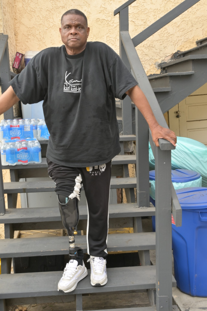 Lunes 28 de junio de 2025. Leibo Glover en su casa de Los Ángeles, California. La pierna del profesional de seguridad fue amputada por debajo de la rodilla. 